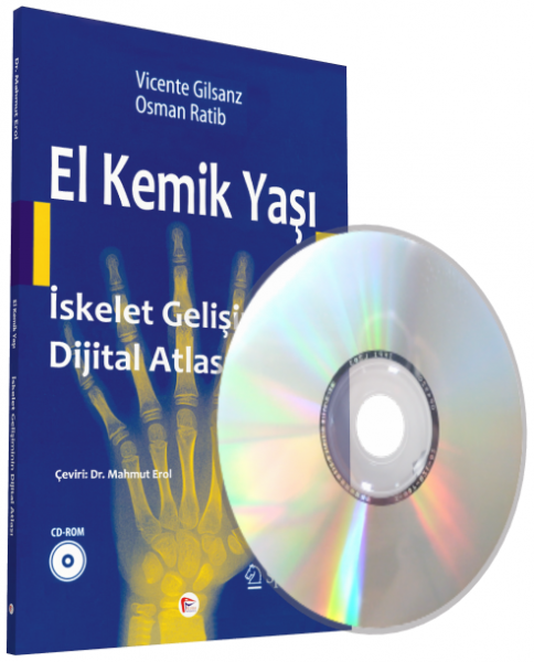 El Kemik Yaşı İskelet Gelişiminin Dijital Atlası Vicente Gilsanz