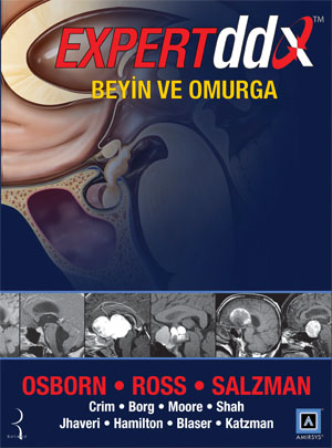 Beyin ve Omurga %378 indirimli Anne G. Osborn