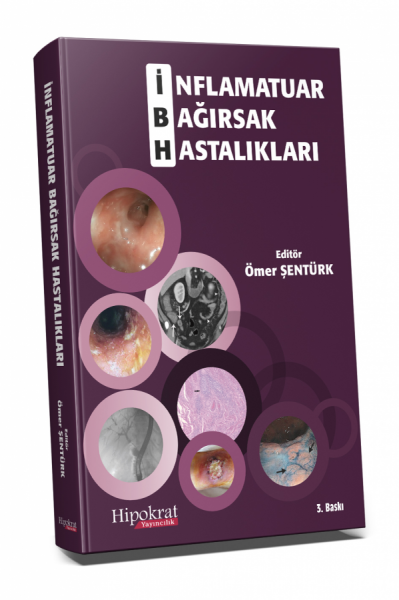 İnflamatuar Bağırsak Hastalıkları