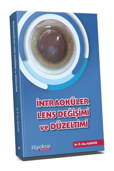 İntraoküler Lens Değişimi ve Düzeltimi Ö. Ulaş Açıkgöz