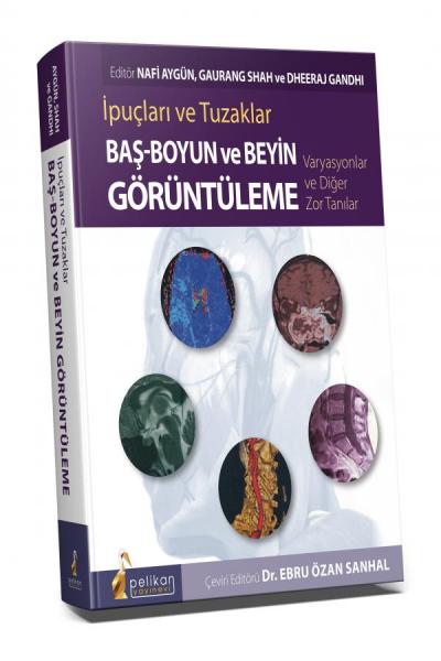 İpuçları ve Tuzaklar Baş - Boyun ve Beyin Görüntüleme Varyasyonlar ve 