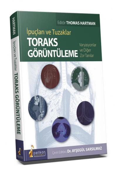 İpuçları ve Tuzaklar Toraks Görüntüleme Varyasyonlar ve Diğer Zor Tanı