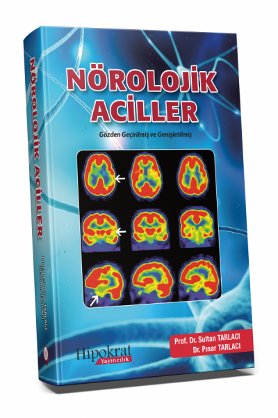 Nörolojik Aciller Sultan Tarlacı