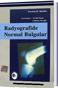 Radyografide Normal Bulgular Tevfik Pınar