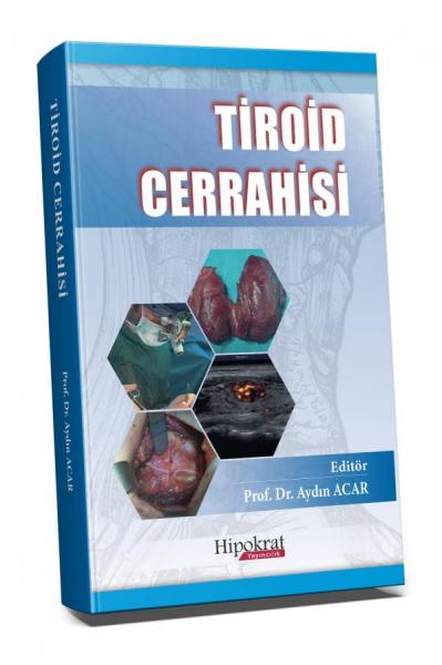 Tiroid Cerrahisi